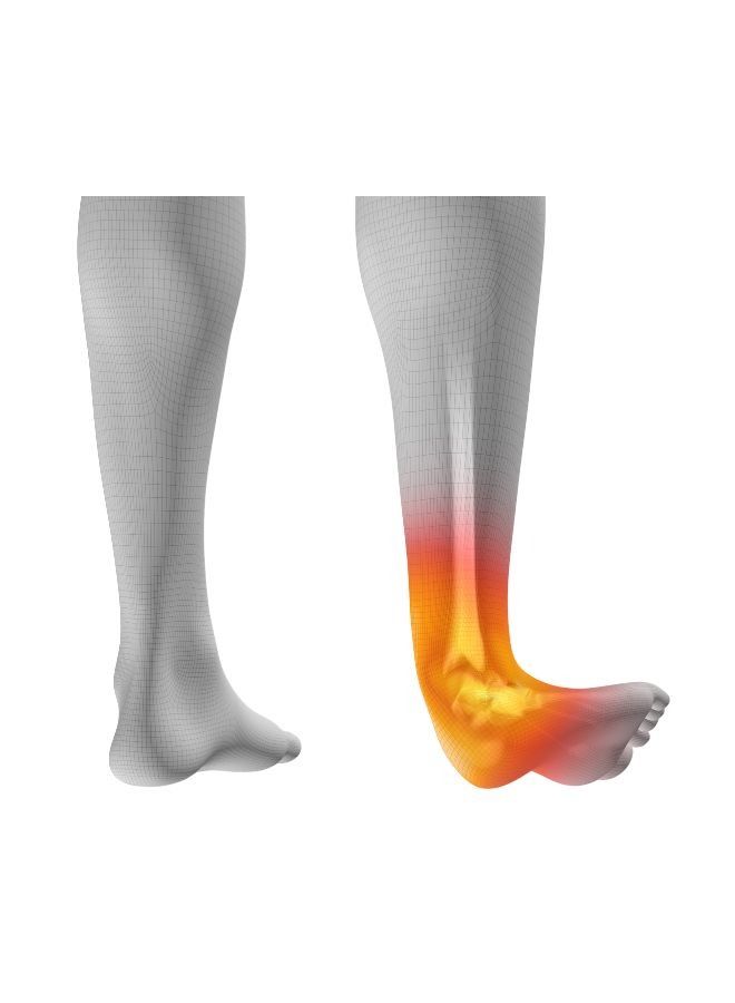 move Ankle Gel Sleeve Support for Swelling and Sprains – MV050 - Image 5