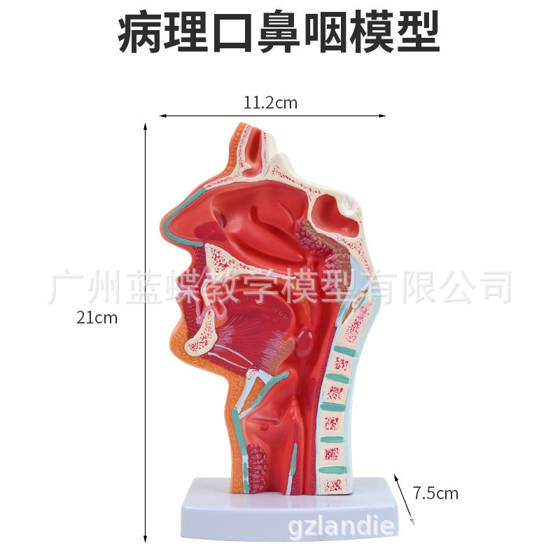 Generic Human Anatomical Nasal Oral Pharyngeal Model Pathological sagittal Ostia of nasopharynx (no numerical identification) 