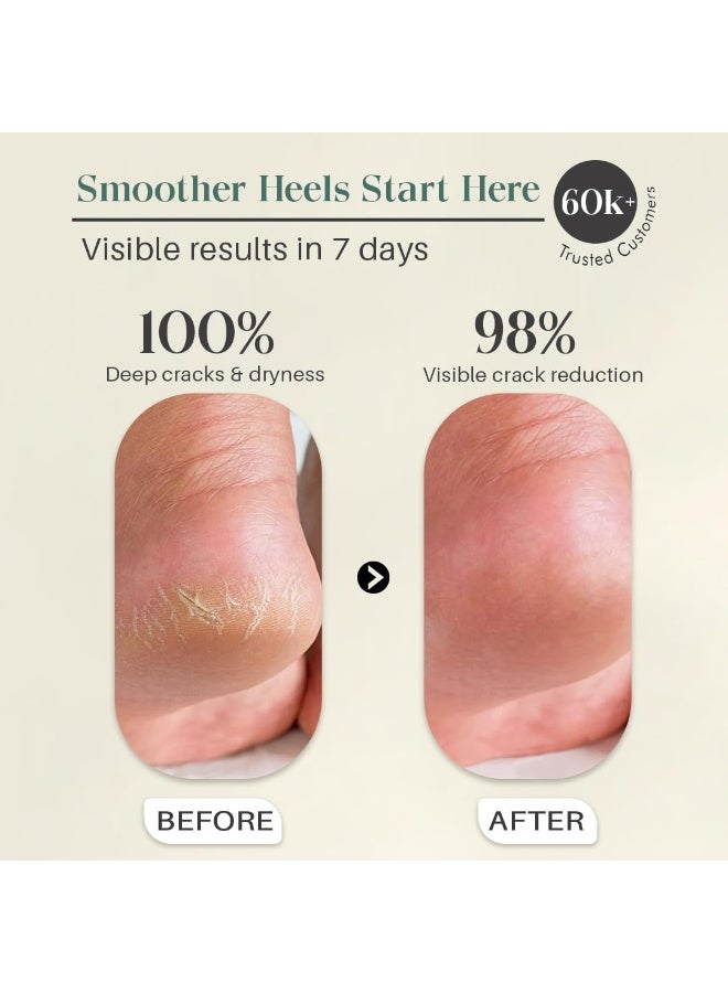 Glamveda Happy Foot cream | Crack Heel Repair Cream for Women | Deep Moisturizing Foot Cream & Crack Cream for Smooth Skin| Suitable for all skin types | 100gm - Image 5