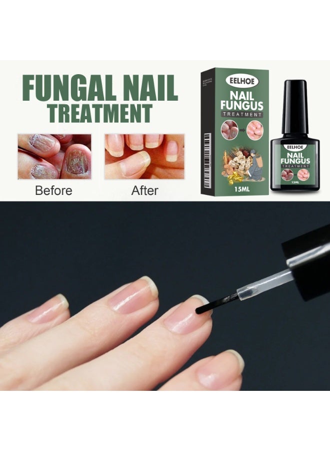 EELHOE Nail Fungus Treatment,Suitable for Repairing Onychomycosis and Dead Skin and Moisturizing Nails - Image 3