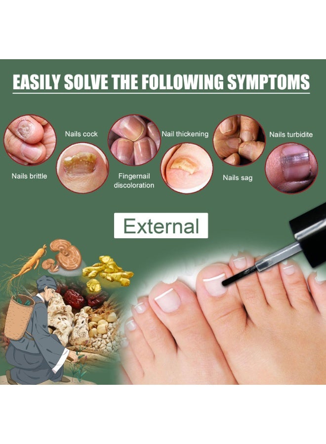 EELHOE Nail Fungus Treatment,Suitable for Repairing Onychomycosis and Dead Skin and Moisturizing Nails - Image 2
