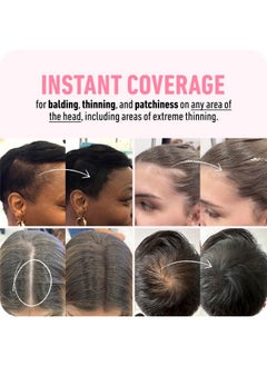 Boldify BOLDIFY Hairline Powder - Root Touch Up & Hair Loss Cover Up, Instant Gray Coverage 48-Hour Stain-Proof Hair Color Powder for Women & Men, Hair Fibers and Hair Topper Alternative (Dark Blonde)  - Image 4