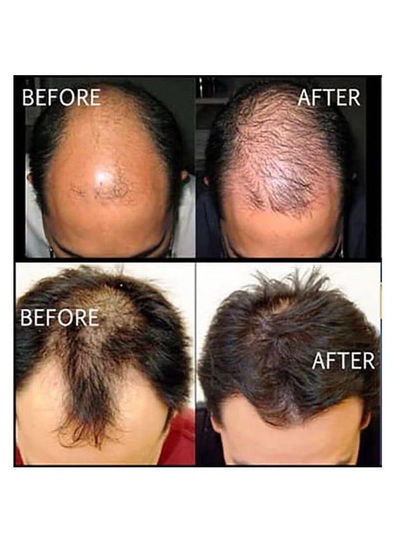 Kirkland Signature - Kirkland Minoxidil 5% 3 Bottles Liquid – 3 Months Supply for Men 180ml - Image 1