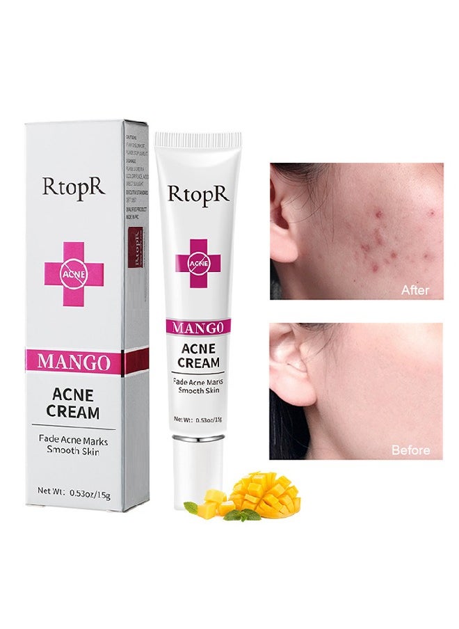 RtopR Mango Acne Cream,Acne Treatment Face Cream, Acne Spot Treatment for Face and Acne Dots, Natural Cystic Acne Treatment, For All Skin Types, Premium Acne Scar Cream and Pimple Remover 15g  - Image 1