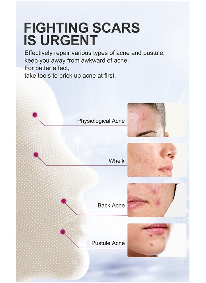 RtopR Mango Acne Cream,Acne Treatment Face Cream, Acne Spot Treatment for Face and Acne Dots, Natural Cystic Acne Treatment, For All Skin Types, Premium Acne Scar Cream and Pimple Remover 15g  - Image 5