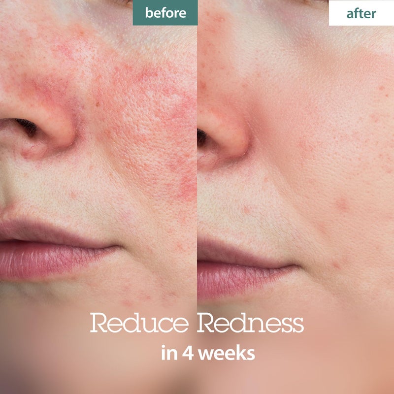 BLITHE Pressed Serum Crystal Iceplant Face Moisturizing Gel - Kbeauty Best Skin Cream for Dry Skin, Korean Serum for Combination Skin & Redness Relief, Face Moisturizer for Dry Skin Cream 1.68 Oz - Image 3