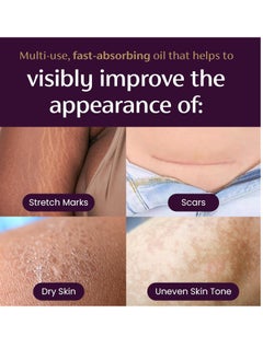 Mederma Mederma Quick Dry Oil, Scar and Stretch Mark Treatment, Helps to Improve the Appearance with Natural Botanical Extracts, Paraben Free, Fast-Absorbing, 3.4oz (100ml)  - Image 5