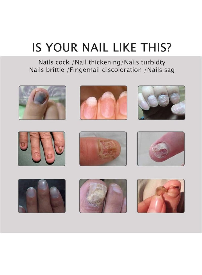 DubaiGallery Foot Stone Remover Toe Beauty Cream Renews Damaged Nails Split Instant Yellow Toenails Foot & Nail And Cracked Nail & Health Toenail - Image 3