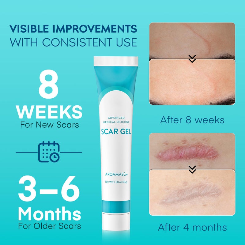 Aroamas Scar Advanced Scar Gel - Medical-Grade Silicone Scar Gel to Help Improve The Appearance of Scars and Stretch Marks for Face & Body - 45g - Image 3