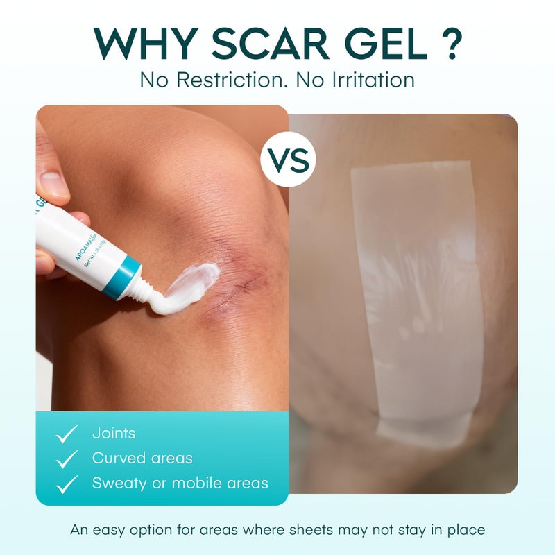 Aroamas Scar Advanced Scar Gel - Medical-Grade Silicone Scar Gel to Help Improve The Appearance of Scars and Stretch Marks for Face & Body - 45g - Image 4