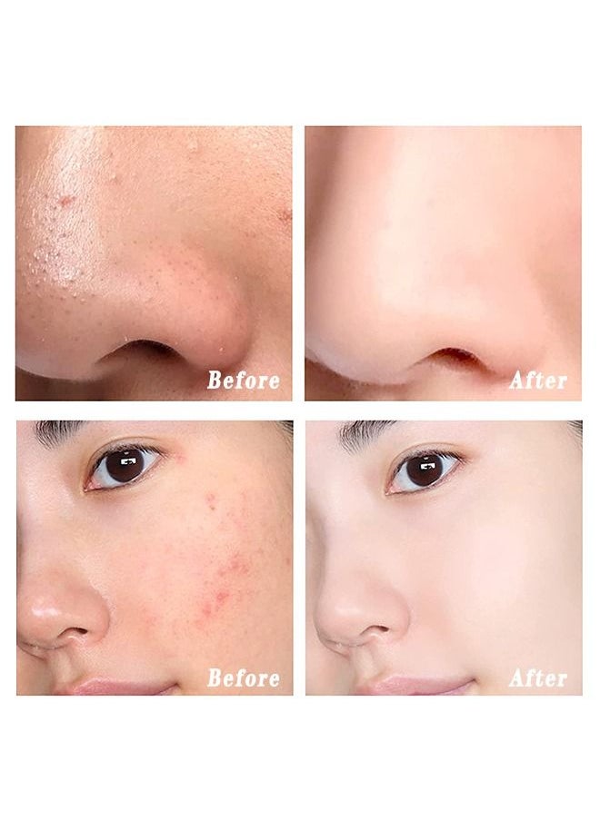 KDK - Double Tubule Color Correcting Facial Primers, B-B Creams and Isolation Creams in One, Neutralizes Uneven Skin Tones and Redness, Invisibled Pore, Cover Acnes Marks, Oil Control Foundation - Image 1