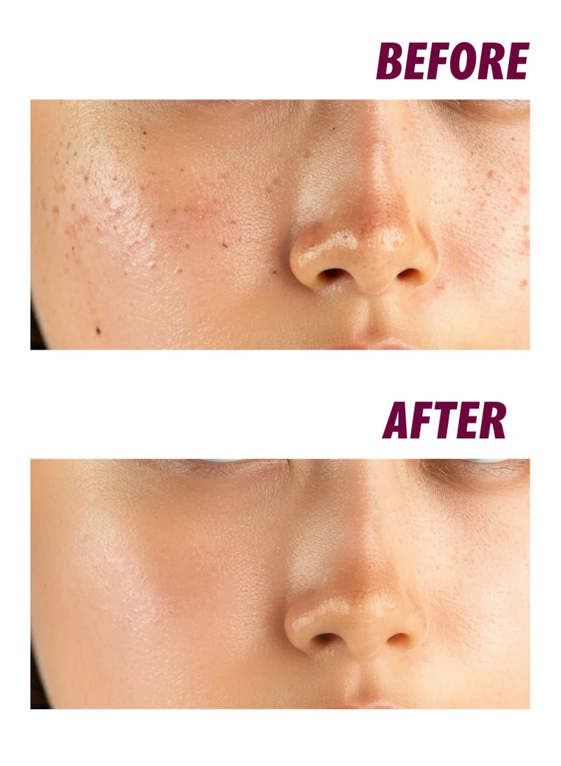 nightingale Korean Cepa Cica Ampoule Serum for Face 30ml - Repair & Moisturizing, Anti Aging