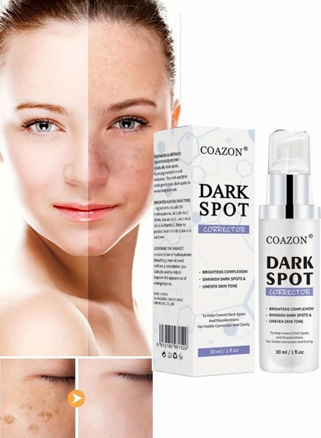 COAZON Dark Spot Corrector for Face Dark Spot Corrector Serum Hyperpigmentation Treatment Advanced and Natural Formula Removes Freckles Sunspots and Melasma Dark Spot Remover 30ml  - Image 1