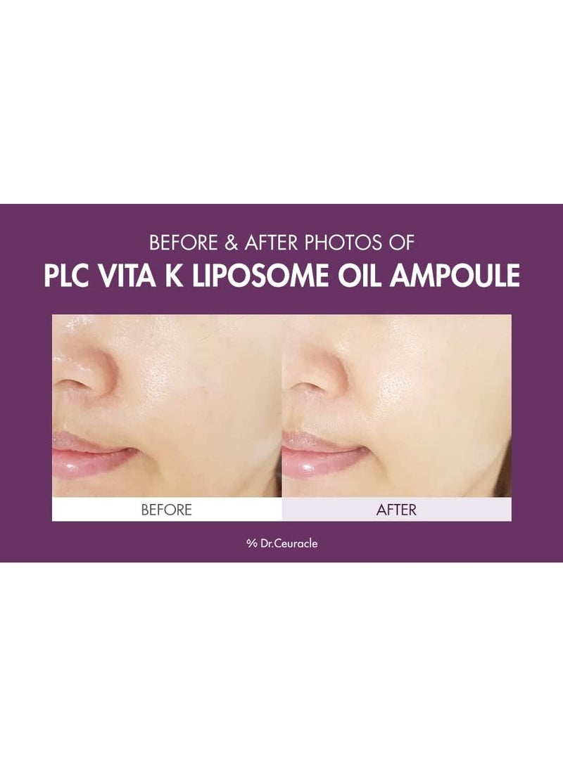 Dr. Ceuracle Vitamin K Liposome Oil AmpouleㅣSpecial Care for Toning, Glowing, Hydration, BrighteningㅣSkin-Friendly Water&Oil Layer FormulaㅣSerum for Dark Area 50ml - Image 5