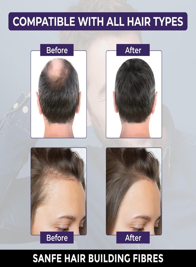 Sanfe Instant Bald Spot Covering Fibers (22g) | For Fine and Thinning Hair for an Instantly Thicker & Fuller Look - Best Value & Superior Formula | Black - Image 4