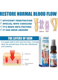SOUTH MOON Veinhealing Varicose Veins Treatment Spray and Cream: Your Comprehensive Solution for Soothing Legs, Treating Varicose and Spider Veins Effectively  - Image 5