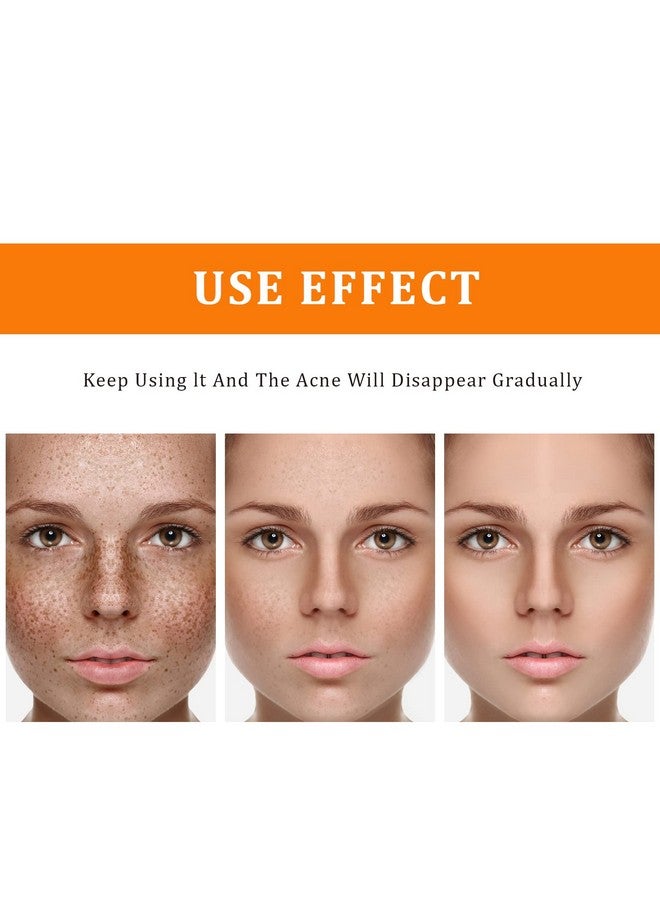 YAFUSIPE Toner for Dark Spots Turmeric Dark Spot Corrector Toner, Facial Toner for Acne Prone Skin, Dark Spot Remover for Face Hydrating Face Toner for Women, Moisturizing Toner Face for Dry Oily Skin- 4OZ - Image 2