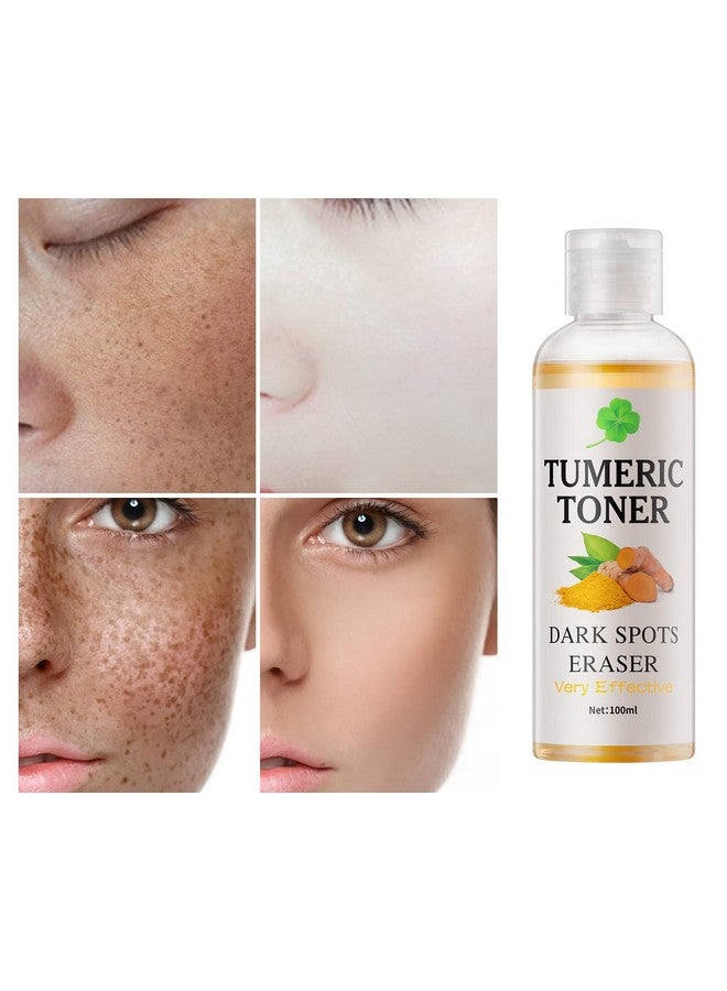 YAFUSIPE Toner for Dark Spots Turmeric Dark Spot Corrector Toner, Facial Toner for Acne Prone Skin, Dark Spot Remover for Face Hydrating Face Toner for Women, Moisturizing Toner Face for Dry Oily Skin- 4OZ - Image 3