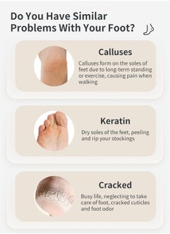 ACK Electric Foot Callus Remover Skin Exfoliator Electric Foot Grinder  Foot Skin Repairing Machine Foot Care Tools White  - Image 3