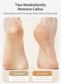 ACK Electric Foot Callus Remover Skin Exfoliator Electric Foot Grinder  Foot Skin Repairing Machine Foot Care Tools White  - Image 4