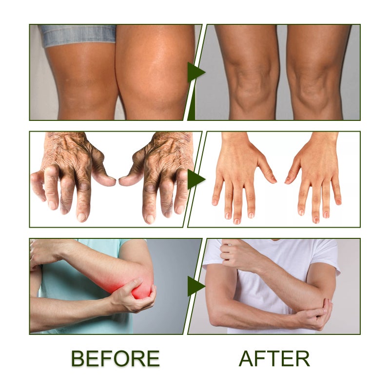 Joint Support Cream: 30g Green High Concentration Safe Formula - Fast Skin Absorption Pain Relief Cream for Joint Bone Health Mobility Enhancement - Image 4