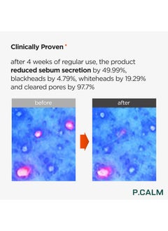 P.CALM P.CALM Underpore Facial Foaming Cleanser 250 ml | Vegan Deep Pore Cleansing Facial Wash for Sensitive Skin | Korean Skincare  - Image 4