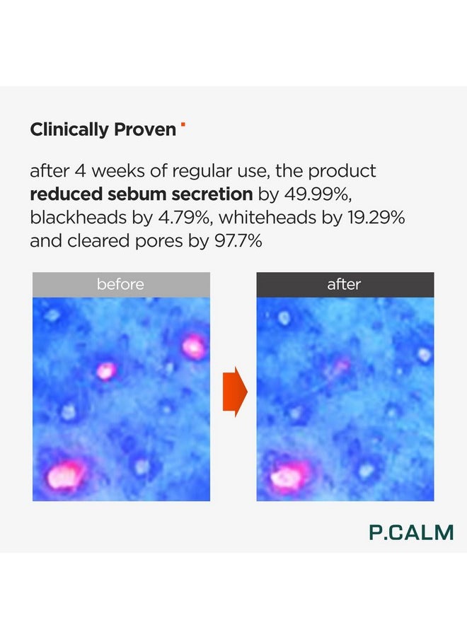P.CALM P.CALM Underpore Facial Foaming Cleanser 250 ml | Vegan Deep Pore Cleansing Facial Wash for Sensitive Skin | Korean Skincare  - Image 4