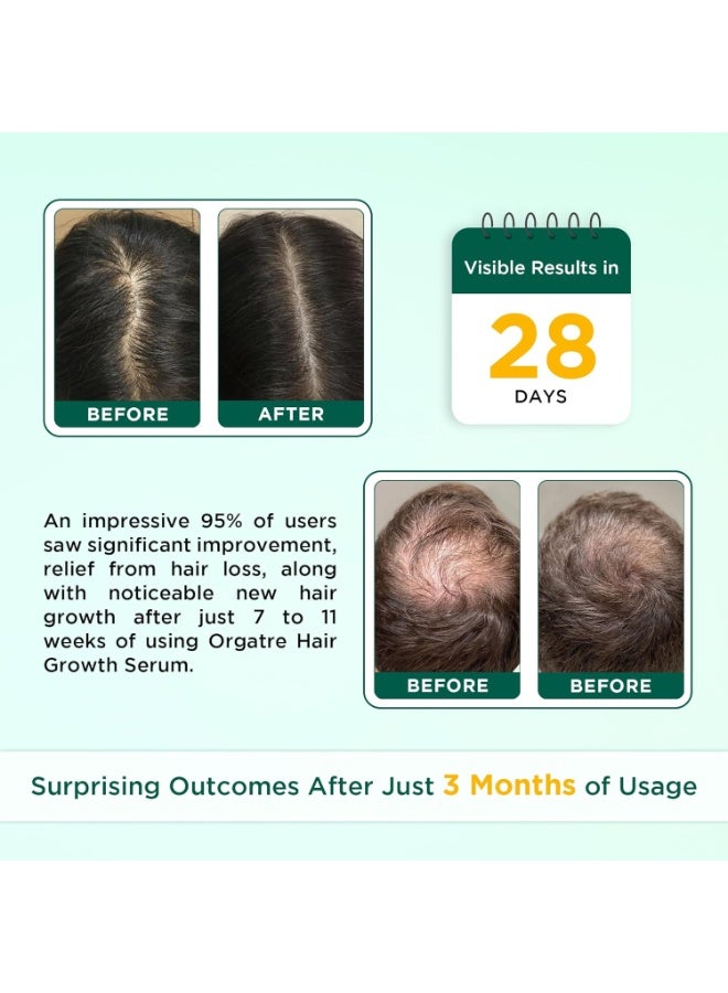 Orgatre Hair Growth Serum for scalp - 50ml | 3% Redensyl, 4% Anagain, 3% Procapil, 1% Capilia Longa & Rosemary Oil | Scalp Treatment & Hair Tonic for Men & Women | Effective Hair Regrowth Formula - Image 4