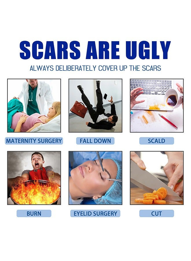 Dermatix Advanced Scar Formula with Innovative CPX Technology and Unique Vitamin C Ester, Advanced Scar Gel 15g For Cosmetic Improvement of Scars, Fast Drying and Unique Silicone Gel Formulation, Used For Treatment of Keloids, Surgical and Hypertrophic Scars, Suitable For Sensitive Skin - Image 4