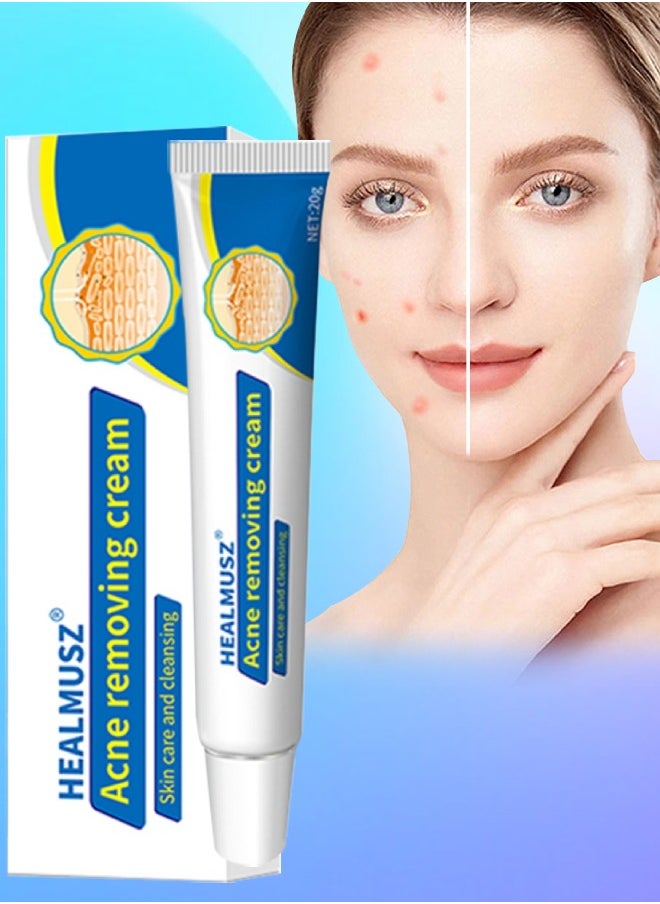 HEALMUSZ - Acne Removing Cream Acne Treatment Cream Skin Care and Cleansing Clear Face and Body Acne Blemish Cream for Acne and Blackheads Pimple Treatment Cream Natural Moisturizing Cream 20g - Image 1