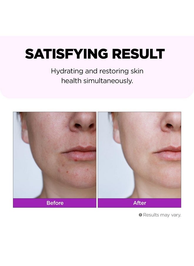 FARMSKIN Superfood For Skin Hyalusteen Repair Toner - Facial Hydrationg Toner/Korean Skincare Soothing Toner For Face (5.07Fl.Oz, 150Ml)  - Image 3
