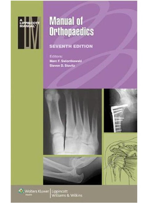 Manual of Orthopaedics