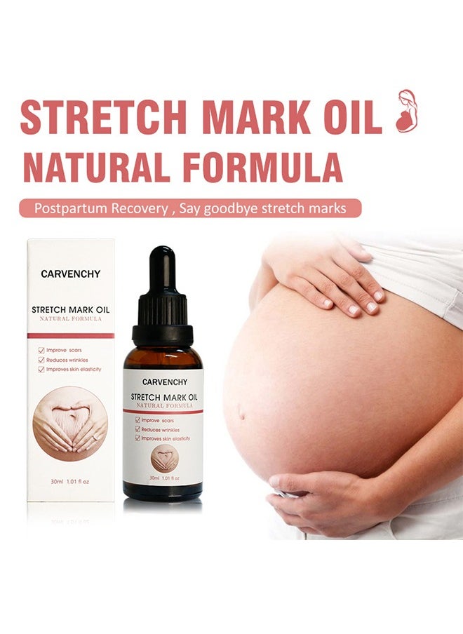 CARVENCHY - Stretch Mark Oil ,100% Natural Pure Plant Extract 30ML,Stretch Marks Remover, Essential Oil Skin Care Treatment For Stretch Mark,Removal Maternity Slackline & Scar Removal - Image 1