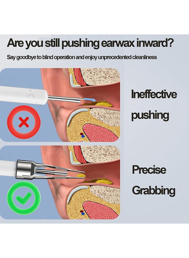 GD Ear Wax Removal Kit, 6 LED Lights Wireless Earwax Removal Tool with Replacement Tips, Waterproof Rechargeable Smart Visual Ear Cleaner - Image 2