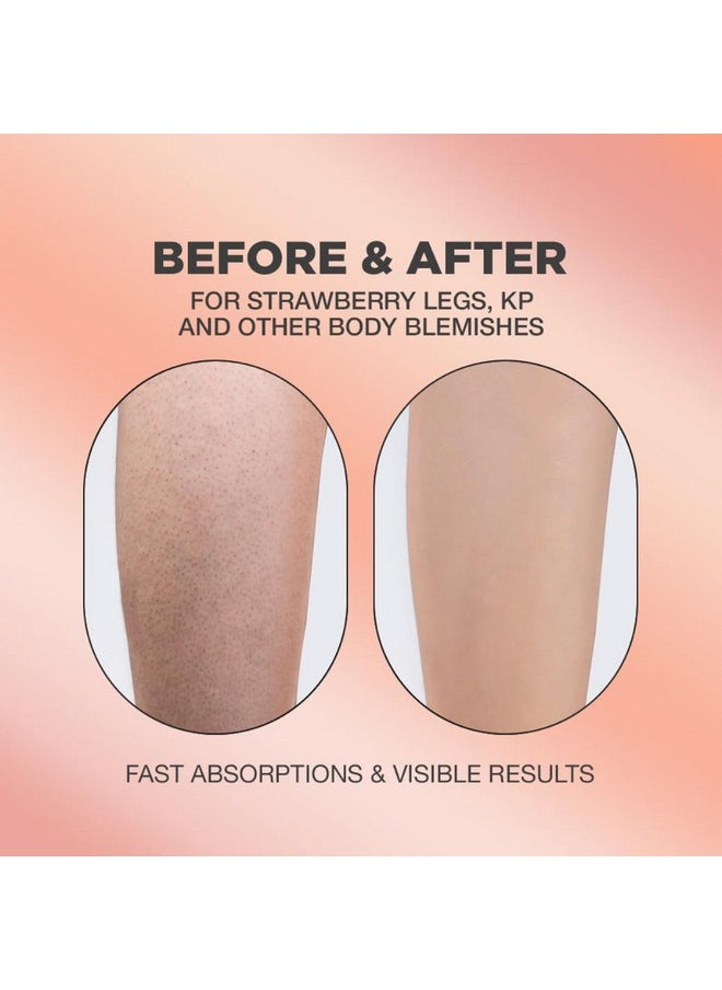 Proot - Strawberry Legs Treatment For Women Body Serum Strawberry Legs Treatment For Women Exfoliating Body Serum Chicken Skin Treatment Body Serum Targets Strawberry Legs Treatment For Women - Image 1