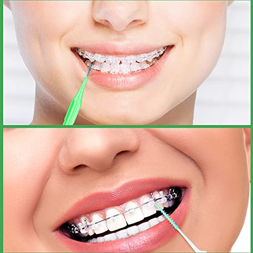 Zopeal 250 Pieces Braces Flossers Interdental Brush for Cleaner Tooth Toothpick Dental Teeth Flossing Picks Head Oral Dental Hygiene Cleaning Tool Soft Cleaners - Image 4