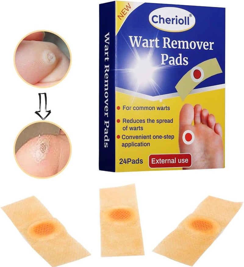 Cherioll Wart Remover Corn Complete Removal Corn Remover Foot Corn Remover Pads Plantar Wart Removal Penetrates and Removes Common and Plantar Warts Callus Stops Wart Regrowth - Image 4