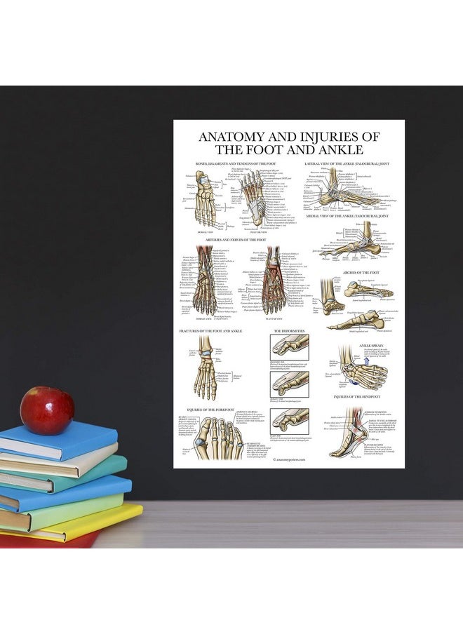 Palace Learning Palace Learning 2 Pack - Anatomy and Injuries of the Hand & Wrist + Anatomy and Injuries of the Foot & Ankle - Set of 2 Anatomical Charts - Laminated 18" x 24"  - Image 5