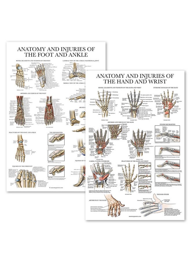 Palace Learning Palace Learning 2 Pack - Anatomy and Injuries of the Hand & Wrist + Anatomy and Injuries of the Foot & Ankle - Set of 2 Anatomical Charts - Laminated 18" x 24"  - Image 1