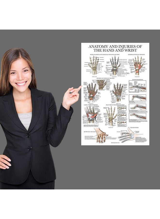 Palace Learning Palace Learning 2 Pack - Anatomy and Injuries of the Hand & Wrist + Anatomy and Injuries of the Foot & Ankle - Set of 2 Anatomical Charts - Laminated 18" x 24"  - Image 4