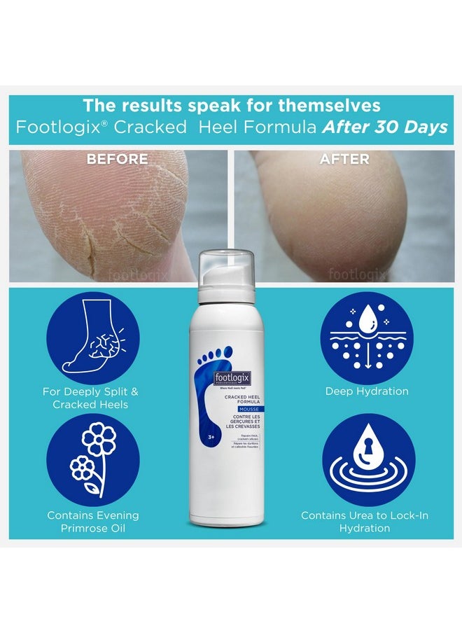 Footlogix - FOOTLOGIX Cracked Heel Formula, White 4.23 Ounce - Image 1