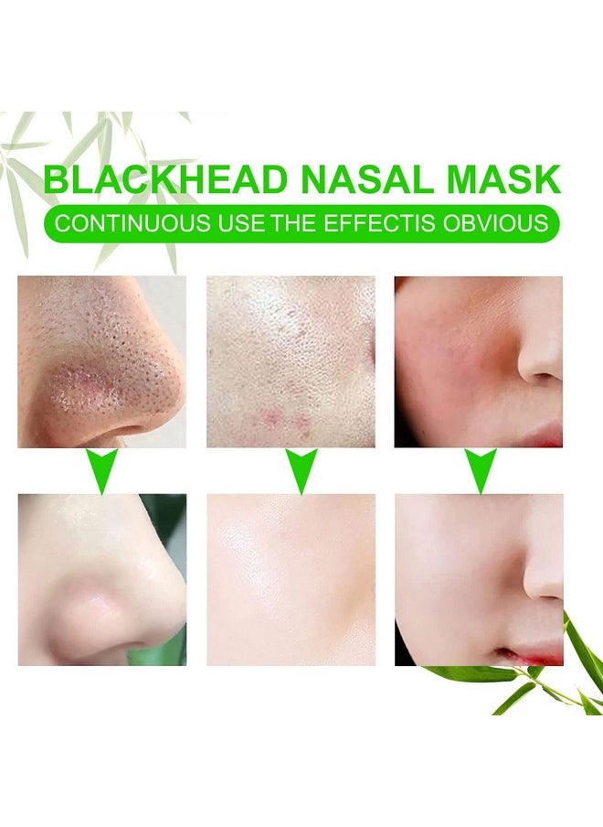 AGETITY - Nose Strips For Blackheads Pore Strips Blackhead Remover For Face Nose Blackhead Remover Strip Nose Pore Strips Black Head Remover For Women Men (80) - Image 1