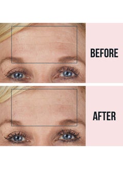 Sio SiO Beauty BrowLift Forehead Anti-Wrinkle Patch - Rapid Overnight Reusable Silicone Patch to Reduce Furrows, Expression Lines, and Creases  - Image 2