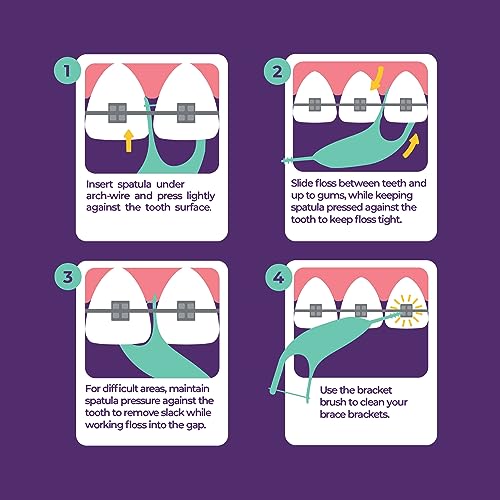 Platypus Orthodontic Flossers for Braces, 30 Count (Pack of 5), Ortho Picks for Adults & Kids, Fits Under Arch Wire, Non-Damaging, Encourage Flossing Habits - Image 3