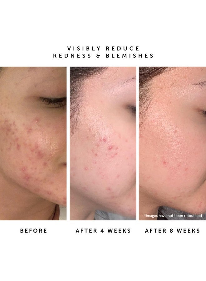 HERBIVORE Lapis Blue Tansy Face Oil - Skin-Balancing Moisturizer for Oily, Acne-Prone Skin | Redness Soothing, Azulene-Rich, Plant-based, Vegan, Cruelty-free, 50 mL / 1.7 oz - Image 4