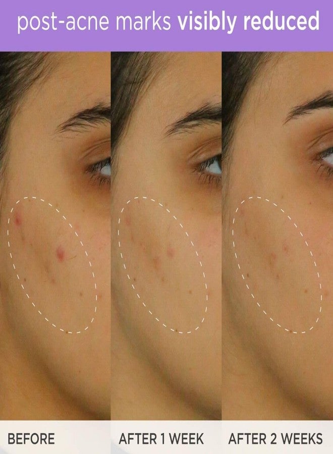 TATCHA سيروم التبييض | علاج فيتامين C لبشرة أكثر إشراقًا وثباتًا - يستهدف فرط التصبغ ويخفف آثار حب الشباب، 30 مل / 1.0 أونصة سائلة - Image 5