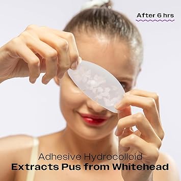 AVARELLE Nose Patch Pore Oil Control Hydrocolloid Pore Strips for Nose Pore Oil Blackhead Pimples and Zits Large Pore Oil Absorbing Nose Strips for Overnight 16 PATCHES - Image 2