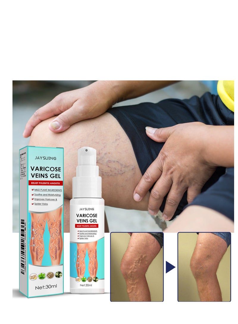 Jaysuing Varicose Veins Gel 30 ml  - Image 1