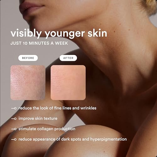 Nood NEW Nood™ Flasher Pro — IPL Laser Hair Removal Device for Women & Men with Sapphire Cooling — Pain-free & Permanent, Visible Results After First Use & Works Everywhere Hair Grows — Gloss White - Image 4