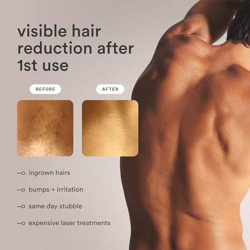 Nood NEW Nood™ Flasher Pro — IPL Laser Hair Removal Device for Women & Men with Sapphire Cooling — Pain-free & Permanent, Visible Results After First Use & Works Everywhere Hair Grows — Gloss White - Image 3